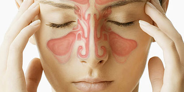 Información sobre la sinusitis