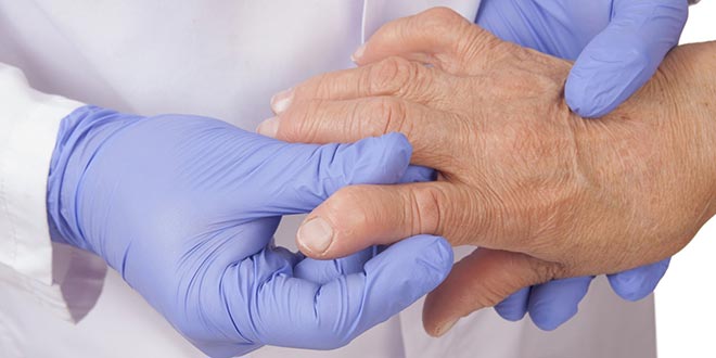 Remedios para eliminar los dolores de artritis