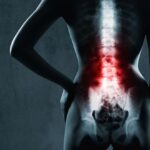 Remedios para el dolor de espalda