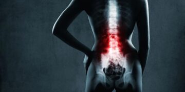 Remedios para el dolor de espalda