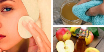 Cómo Limpiar el rostro con vinagre de manzana