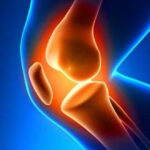 Los mejores remedios para el dolor de rodilla