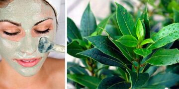 Cómo eliminar el acné con hojas de laurel