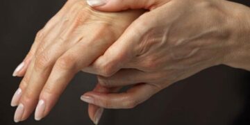 Síntomas y factores de riesgo de la artritis reumatoide