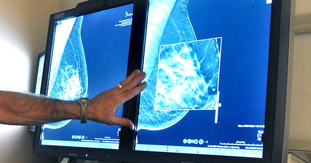 Momografía 3D