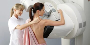 Información sobre la mamografía