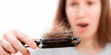 Pérdida de cabello en mujeres