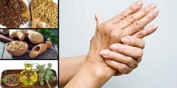 Remedios naturales para el tratamiento de la artritis