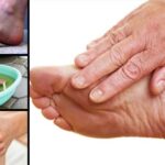 Cómo eliminar el dolor de pies con remedios caseros