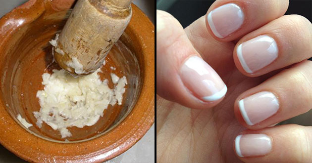 Cómo fortalecer las uñas con un remedio casero
