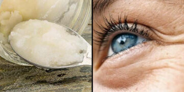 Cómo hacer crema casera para eliminar las arrugas de los ojos