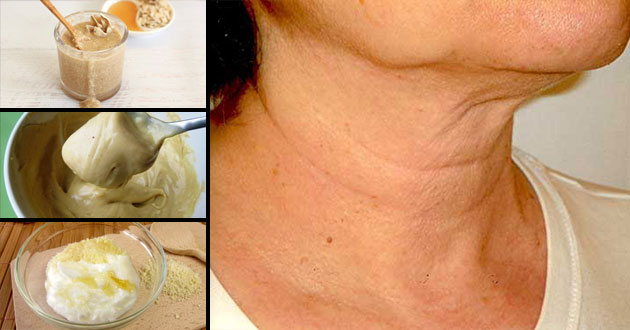 Tratamientos naturales para las arrugas del cuello