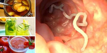 Remedios naturales para eliminar los parásitos intestinales