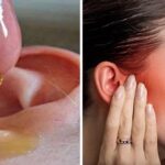 Cómo eliminar el dolor de oído