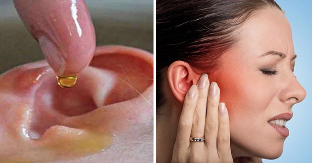 Remedios naturales para quitar el dolor de oído