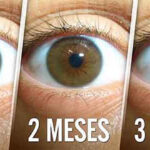 Remedio para reducir cataratas aumentando la visión ocular