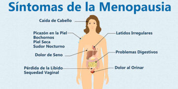 Los síntomas de la menopausia