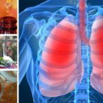 Cómo aliviar los síntomas de la bronquitis