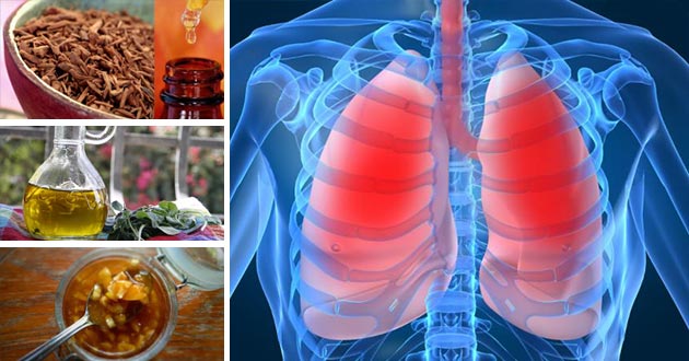 Cómo aliviar los síntomas de la bronquitis de forma natural