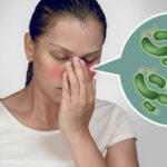 Remedios caseros para aliviar la congestión nasal