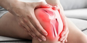 Cómo aliviar el dolor en las rodillas con compresas
