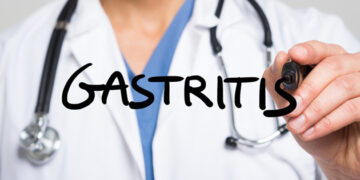 Cómo curar la gastritis